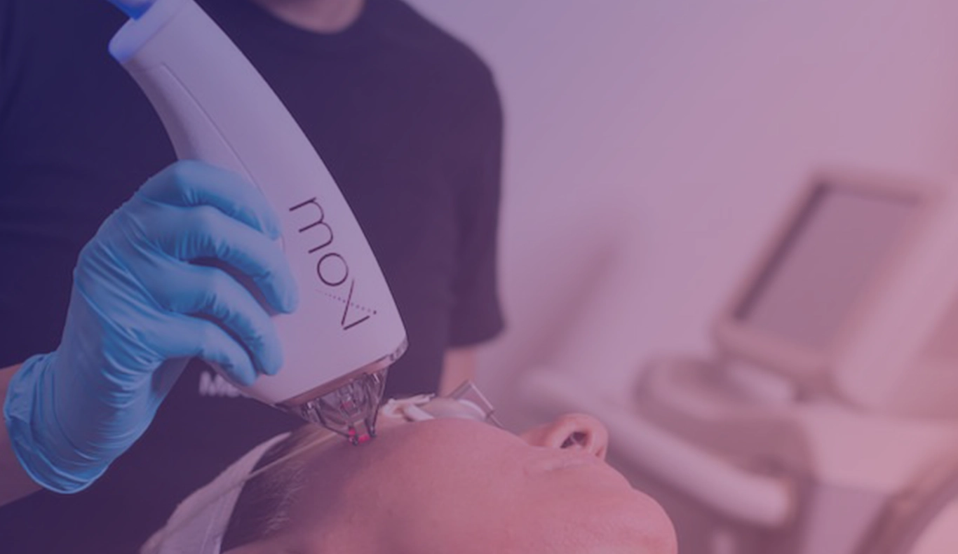 Moxi treatment for skin