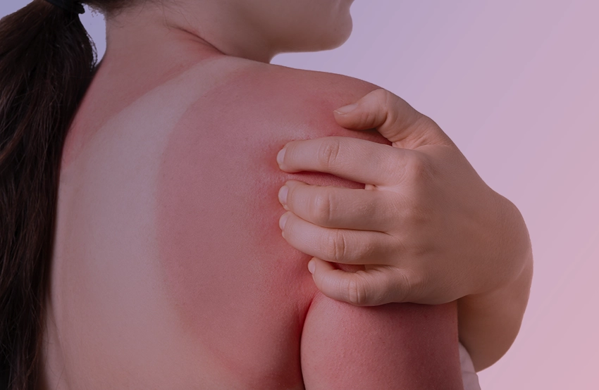 sun damaged skin helpful moxi treatment